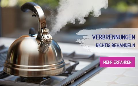 Teaserbild Ratgeber Verbrennungen zuhause behandeln